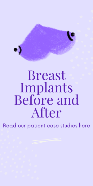 Breast Implants before and after